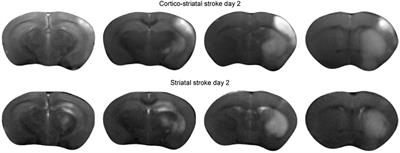 Persistent Quantitative Vitality of Stem Cell Graft Is Necessary for Stabilization of Functional Brain Networks After Stroke